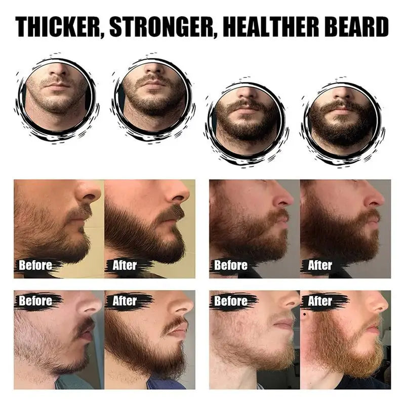 5pcs Men's Beard Kit